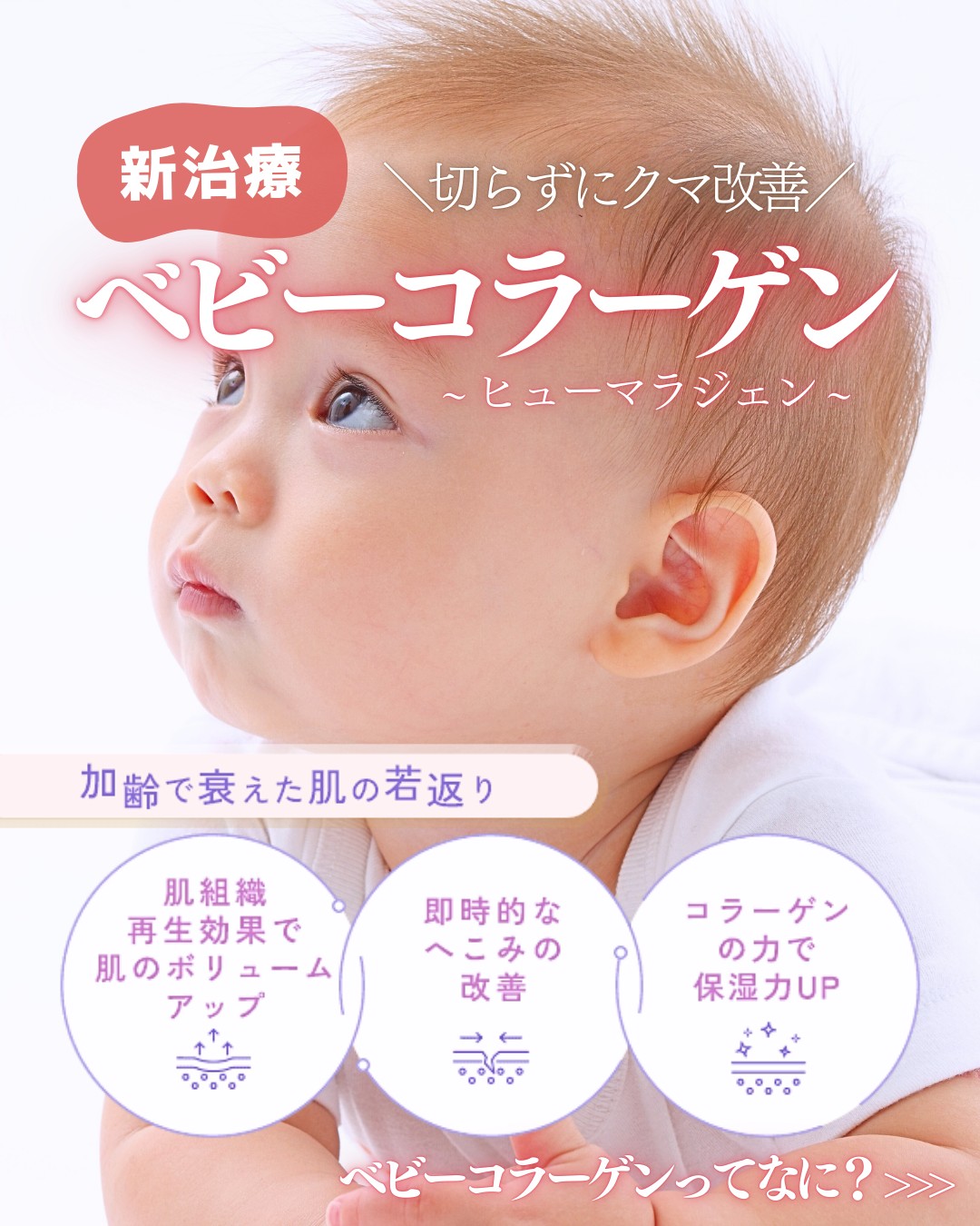 【切らずに即日クマ改善】赤ちゃんの肌に多いコラーゲンを補える新治療👶🏻💖
