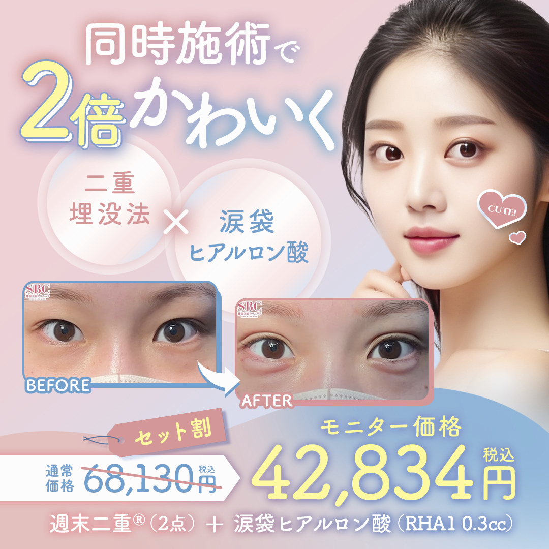 二重×涙袋ヒアルロン酸でデカ目効果👁️✨