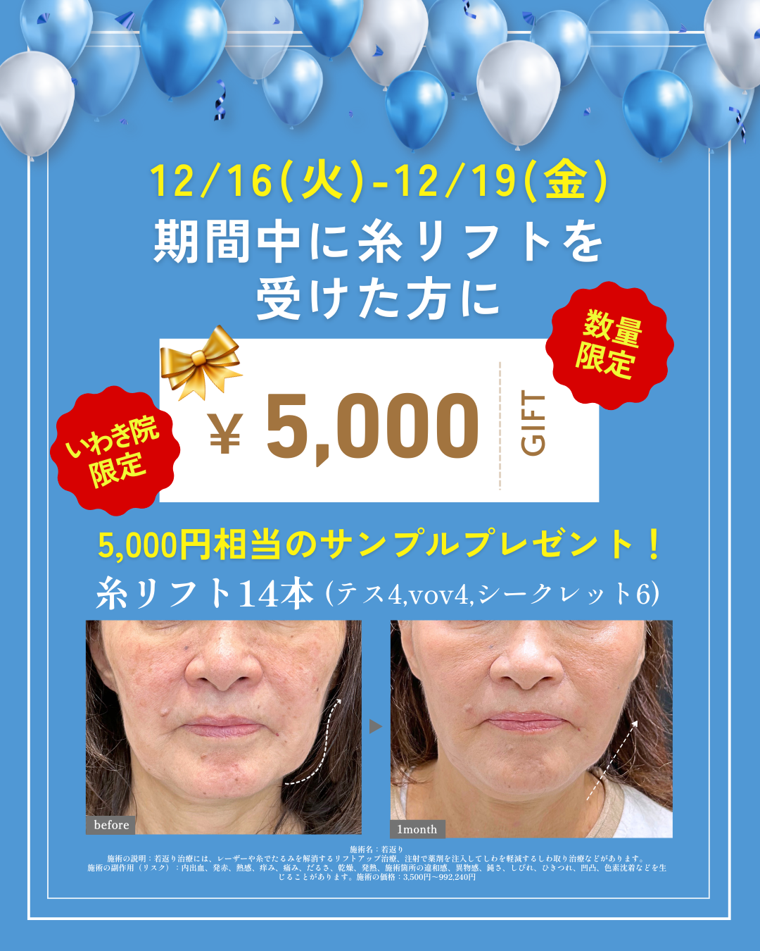 【12/16~12/19】の期間に糸リフトを受けると「5000円相当のサンプル」プレゼント💝✨